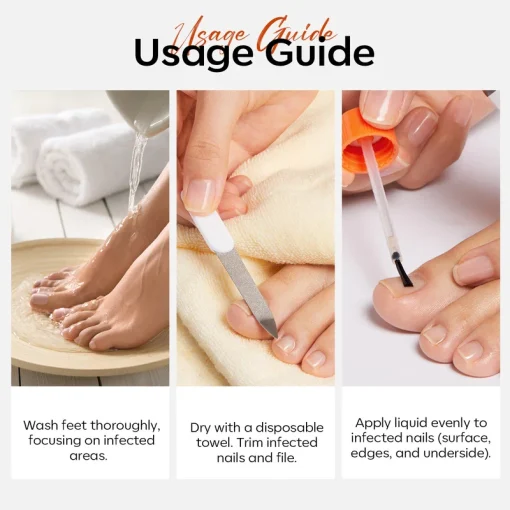 Nail Antifungal Treatment - Image 3