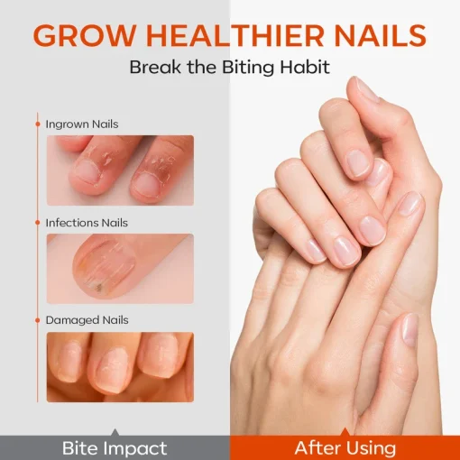 Stop Biting Polish - Image 2